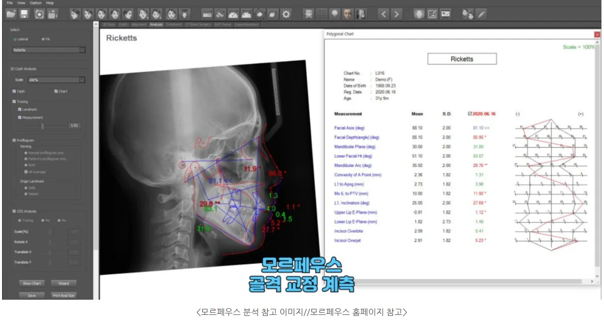 모르페우스 골격 계측 (모르페우스 홈페이지 참고 이미지)
