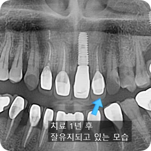 걸포탑치과 게시글 스크린샷