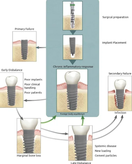 출처: Albrektsson T implant failure osseointegration review 계열 리뷰 논문 도식 (임플란트 실패 메커니즘 개념도, Clinical Oral Implants Research / Periodontology 2000 등)임플란트